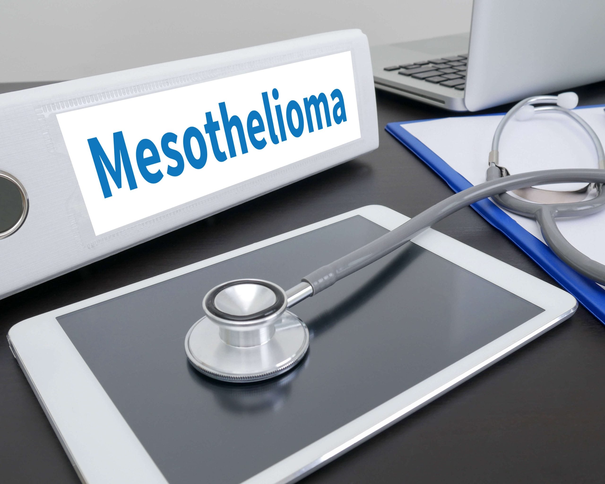 Stages-of-Mesothelioma in Seattle